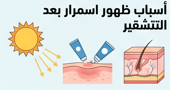 أسباب ظهور اسمرار بعد التشقير